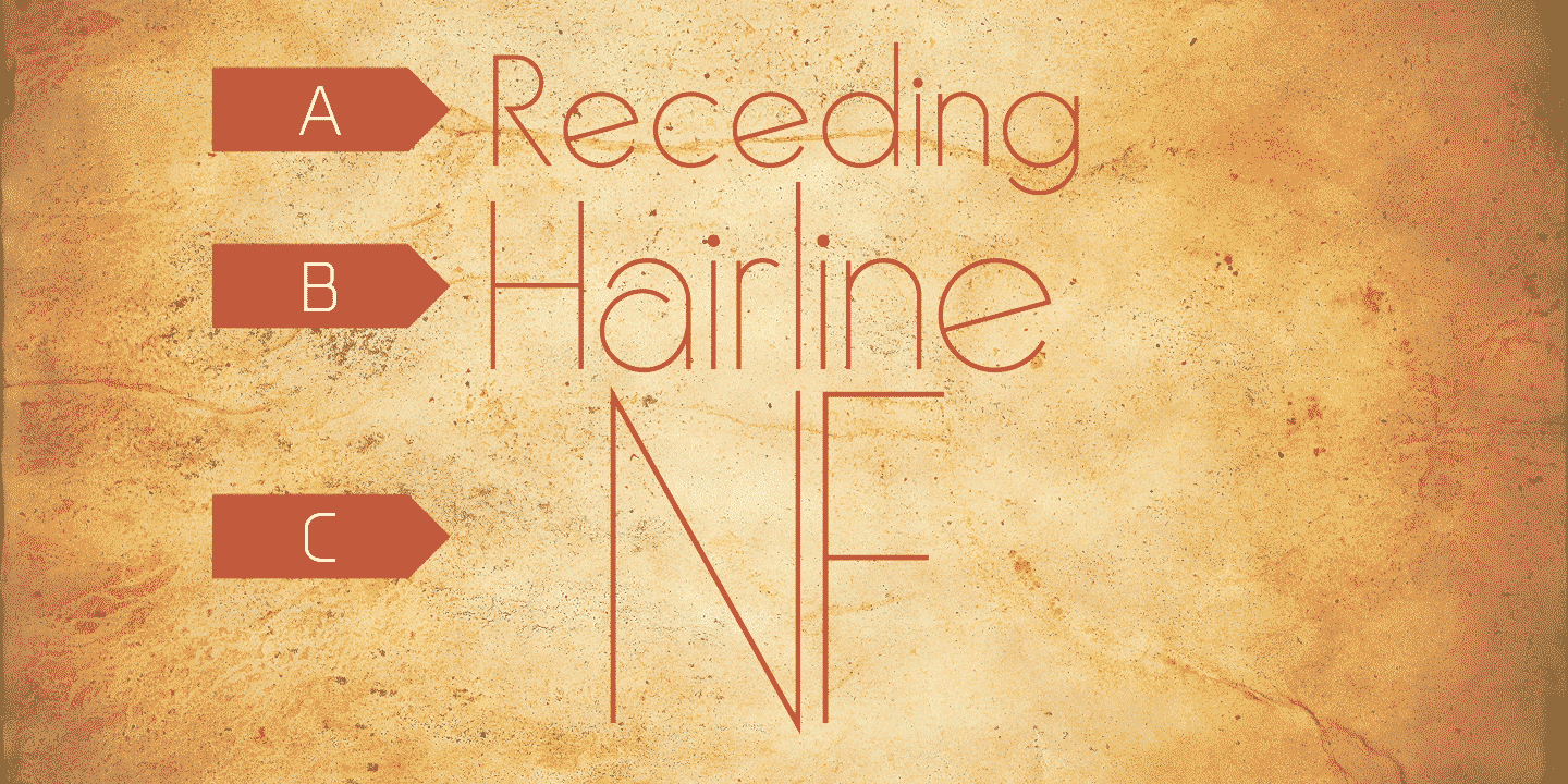 Receding Hairline NF Free Download Free Download